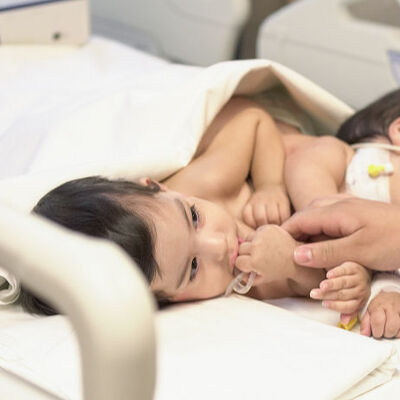 Yapışık ikizler 9 saatlik operasyonla ayrıldı