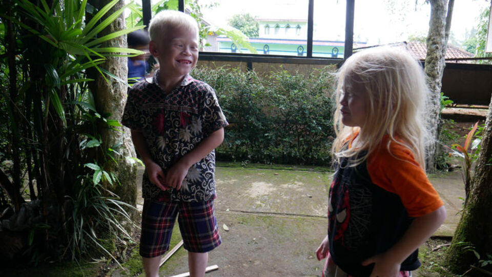 Albinizmli bireyler, insan hakları ihlallerine maruz kalıyor