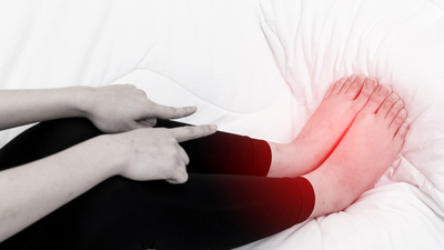 Vücutta ödem belirtileri