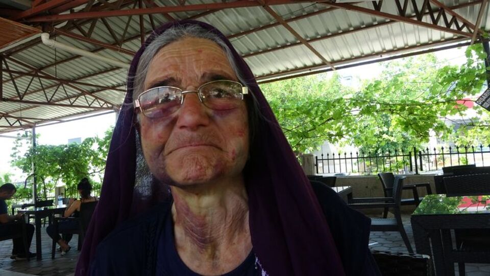 Ellerin kırılsın! Bunu yapan insan olamaz!