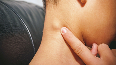 Çocuklarda lenfoma kanseri belirtileri