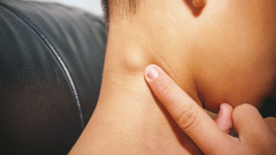 Çocuklarda lenfoma kanseri belirtileri