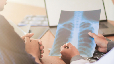 Akciğer kanseri son evre ölüm belirtileri