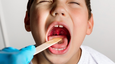 Tonsilit belirtileri