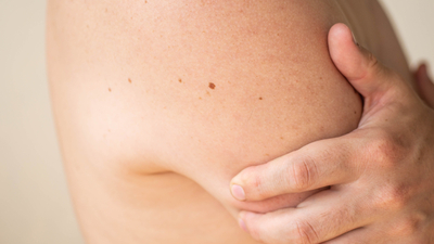 Yumuşak doku kanseri belirtileri