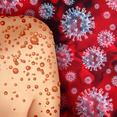 Maymun çiçeği açıklaması!