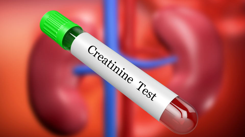 Kreatinin yüksekliği belirtileri