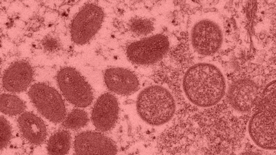 Risk grubundakilere maymun çiçeği virüsü uyarısı!