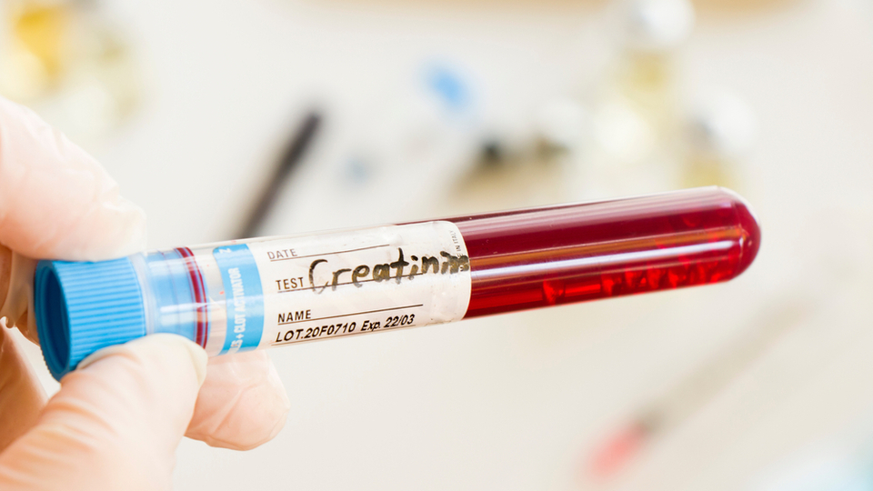Kreatinin normal değeri kaç olmalı?