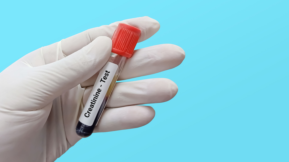 Kreatinin düşüklüğü belirtileri