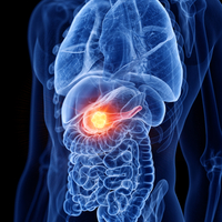 Pankreas kanseri belirtileri ve tedavisi