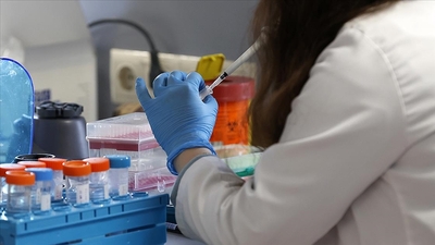 DSÖ açıkladı! Maymun çiçeği kaç kişiyi öldürdü?