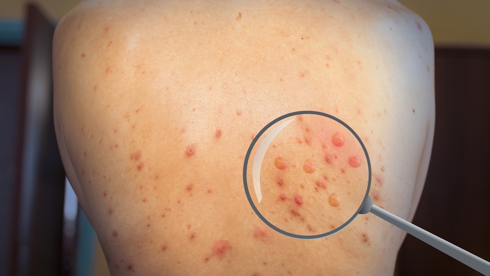 DSÖ açıkladı! 10 bine yaklaştı