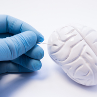 Beyin Tümörü Belirtileri ve Tedavisi