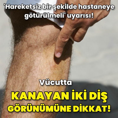 Kanayan iki diş izi görünümüne dikkat!