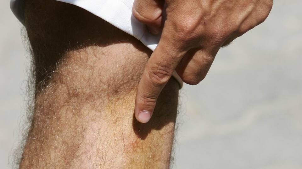 Kanayan iki diş izi görünümüne dikkat!