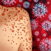 Sağlık Bakanlığı 'maymun çiçeği' rehberi yayınladı