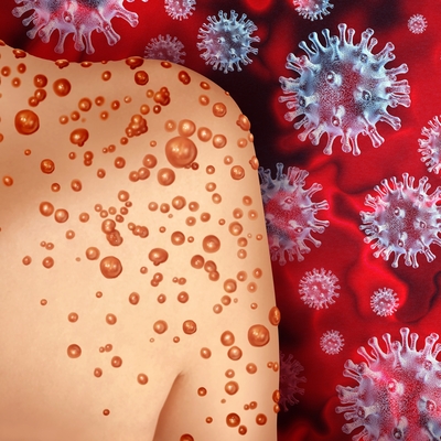 Sağlık Bakanlığı 'maymun çiçeği' rehberi yayınladı