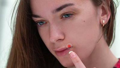 Uçuğa en hızlı ve kesin çözüm yolları