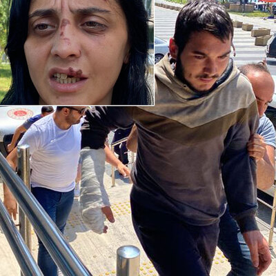 Tanımadığı kadını yumrukladı! Dişlerini kırdı!