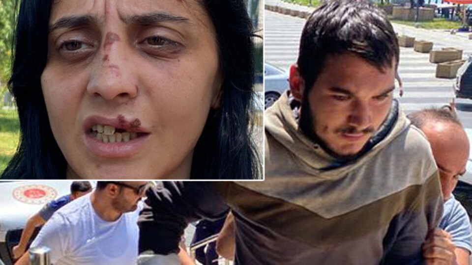 Tanımadığı kadını yumrukladı! Dişlerini kırdı!