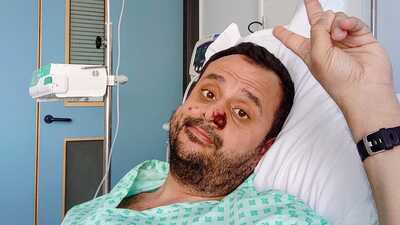 Dünya onu konuşuyor! Maymun çiçeğini yendi ama...