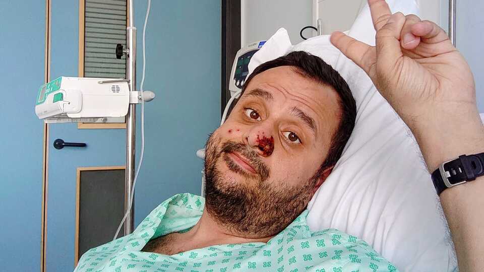 Dünya onu konuşuyor! Maymun çiçeğini yendi ama...