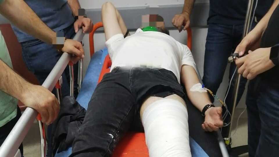 Aranan şahıs araçla polis memurunun bacağını kırdı