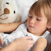 Su çiçeği belirtileri ve tedavisi