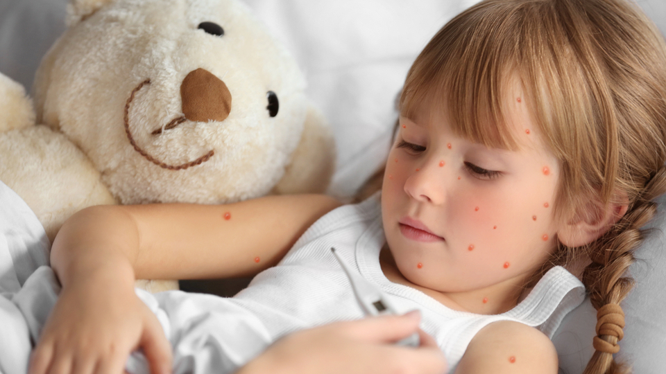 Su çiçeği belirtileri ve tedavisi