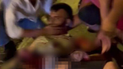 Otoyoldaki yarışı izliyordu! Sağ bacağı koptu!