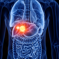 Karaciğer 4. evre hastası ne kadar yaşar?