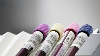 Amilaz nedir ve değeri neden yükselir?