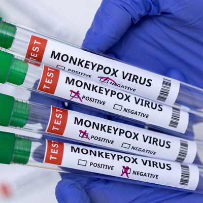 ABD maymun çiçeği nedeniyle acil durum ilan etti