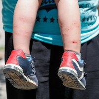 İstanbul'da 'Aedes' tehdidi