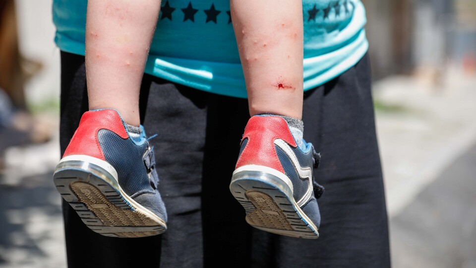 İstanbul'da 'Aedes' tehdidi