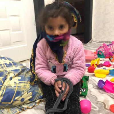 Pitbull saldırısına uğramıştı! Tepki çeken görüntüler! Böyle oyun olmaz!