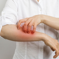 Uyuz belirtileri ve tedavisi