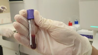 Dikkat! Klima çarpması sandığınız Covid olabilir