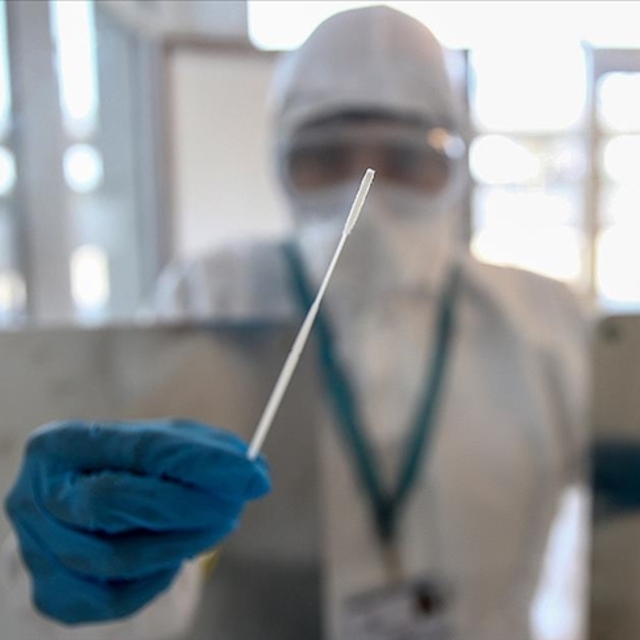 Haftalık vaka sayısı açıklandı! Düşüş sürüyor