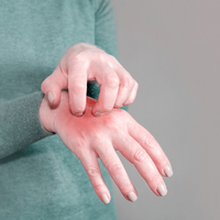 Uyuz hastalığı neden olur ve nasıl geçer?