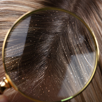 Kepeğe iyi gelen şeyler