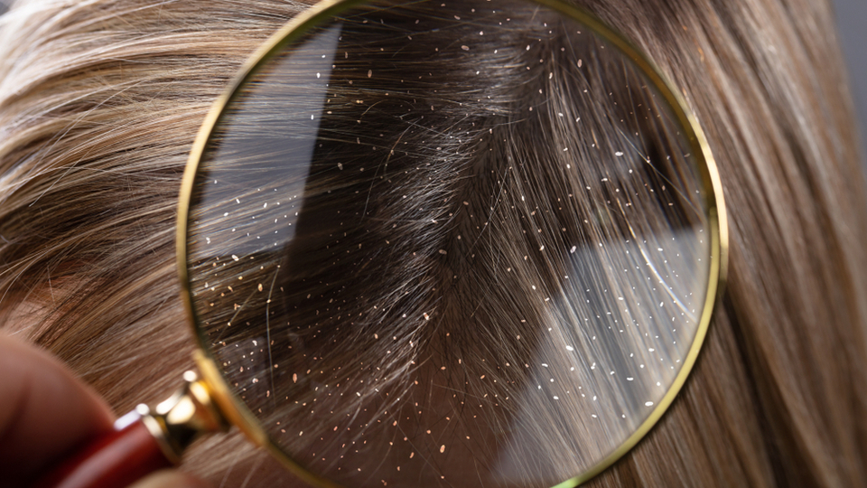 Kepeğe iyi gelen şeyler