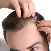 Kepek neden oluşur, nasıl geçer?