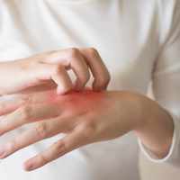 Egzama neden olur ve nasıl geçer?