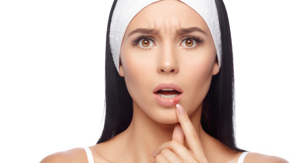 Dudakta uçuk neden olur ve nasıl geçer?