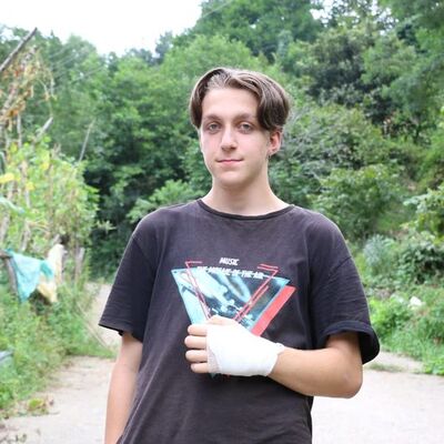 Taş düştü sandı! Röntgende ortaya çıktı