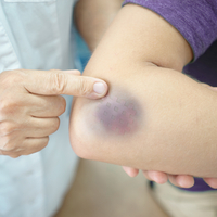 Morluk neden olur, nasıl geçer?