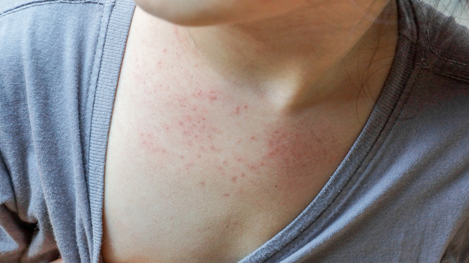 Domates gribine karşı uyarı!