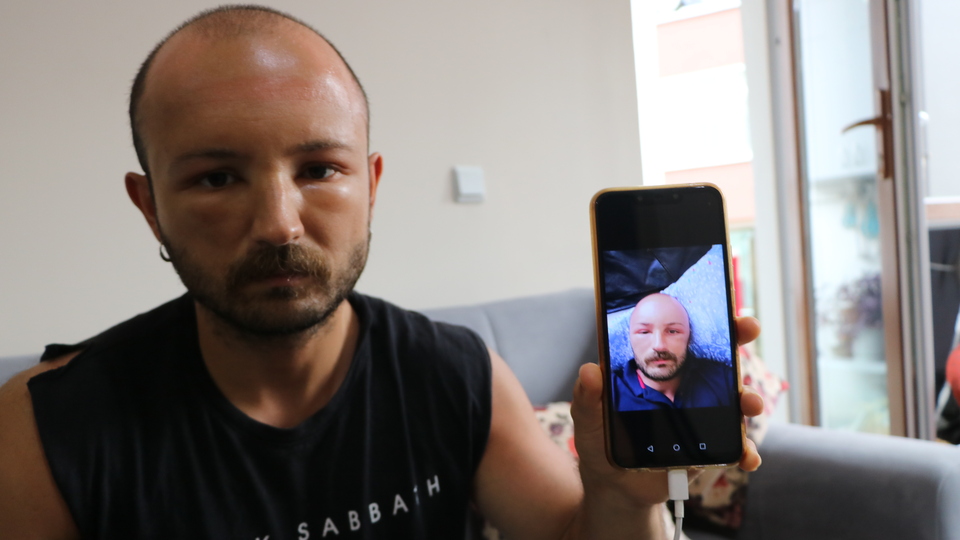 İki gün üst üste plaja gitti! Yaşadıkları şoke etti